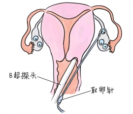 幼儿学画画，金华捐卵宝宝学画画，学画画的好处，如何学画画