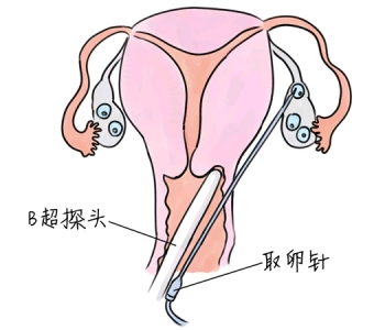 幼儿学画画，金华捐卵宝宝学画画，学画画的好处，如何学画画